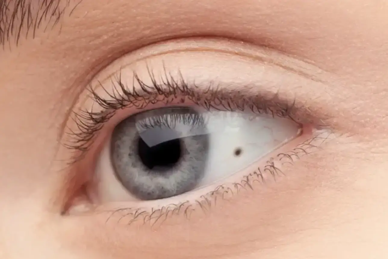 Advanced eye care for diseases and conditions in Gangnam Seoul clinics 2026