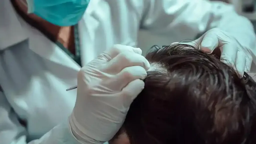 Advanced Alopecia Clinic in Gangnam, Korea – Safe, Effective Hair Restoration